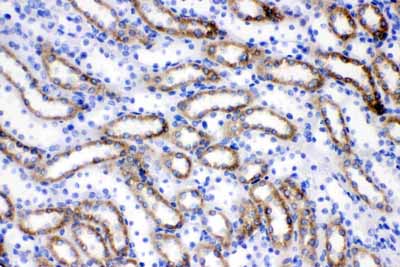 2 - Anti-ACSL1 Picoband Antibody ABO11643