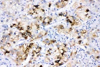 2 - Anti-ACSL1 Picoband Antibody ABO11643