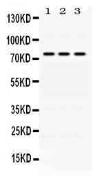 1 - Anti-ACSL1 Picoband Antibody ABO11643