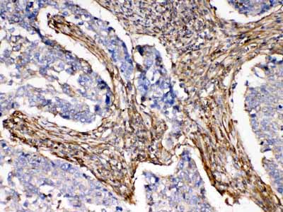 2 - Anti-ACTN3 Picoband Antibody ABO11644