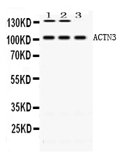1 - Anti-ACTN3 Picoband Antibody ABO11644