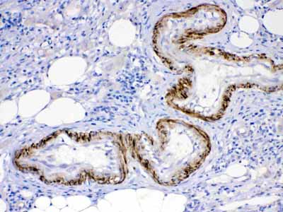 2 - Anti-ACVR2A Picoband Antibody ABO11645