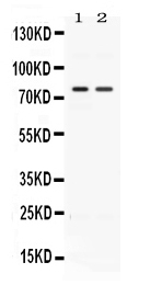 1 - Anti-ACVR2A Picoband Antibody ABO11645