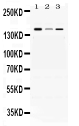 1 - Anti-ADAMTS13 Picoband Antibody ABO11646
