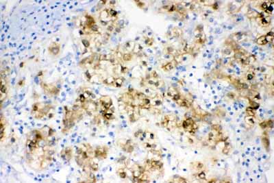 2 - Anti-ADH1A Picoband Antibody ABO11647
