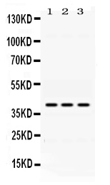 1 - Anti-ADH1A Picoband Antibody ABO11647