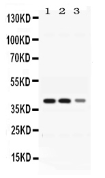 1 - Anti-ADH4 Picoband Antibody ABO11648