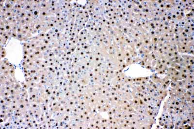 2 - Anti-ADK Picoband Antibody ABO11649