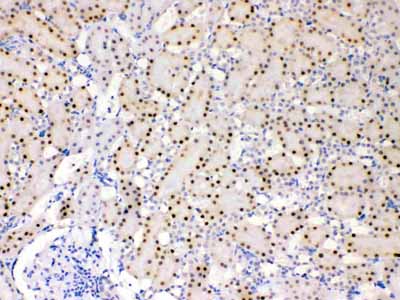 2 - Anti-ADK Picoband Antibody ABO11649