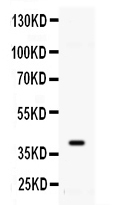 1 - Anti-ADK Picoband Antibody ABO11649