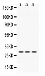 1 - Anti-ADO Picoband Antibody ABO11650