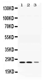 1 - Anti-Adenylate Kinase 1 Picoband Antibody ABO11651