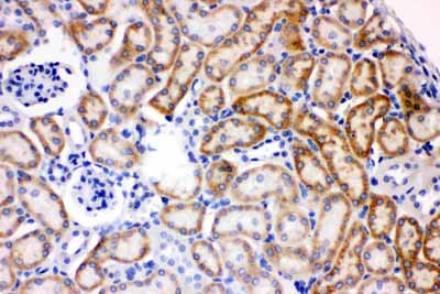 2 - Anti-AK2 Picoband Antibody ABO11652