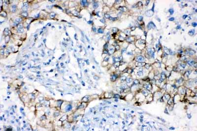2 - Anti-AK2 Picoband Antibody ABO11652