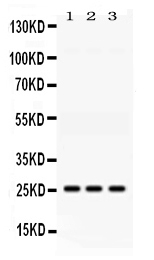 1 - Anti-AK2 Picoband Antibody ABO11652