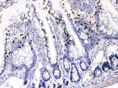 2 - Anti-AKR1B1 Picoband Antibody ABO11653