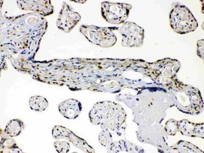 2 - Anti-AKR1B1 Picoband Antibody ABO11653