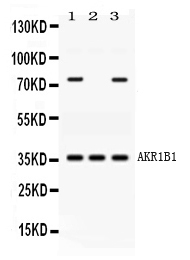 1 - Anti-AKR1B1 Picoband Antibody ABO11653