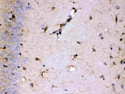 2 - Anti-ALDH7A1 Picoband Antibody ABO11656
