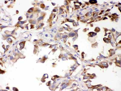 2 - Anti-ALDH7A1 Picoband Antibody ABO11656