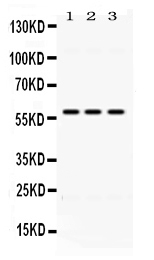 1 - Anti-ALDH7A1 Picoband Antibody ABO11656