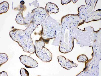 2 - Anti-AMFR Picoband Antibody ABO11657