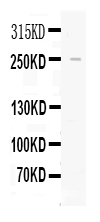1 - Anti-Apolipoprotein B Picoband Antibody ABO11660