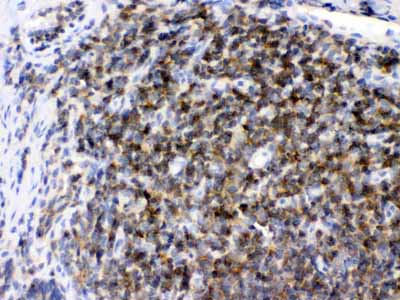 2 - Anti-ARHGEF1 Picoband Antibody ABO11663