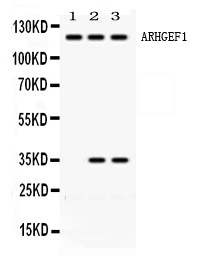 1 - Anti-ARHGEF1 Picoband Antibody ABO11663