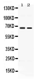1 - Anti-ACCN1 Picoband Antibody ABO11664