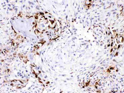 2 - Anti-CA3 Picoband Antibody ABO11667