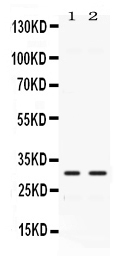 1 - Anti-CA3 Picoband Antibody ABO11667