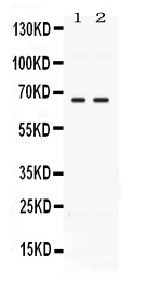 1 - Anti-CCDC6 Picoband Antibody ABO11668