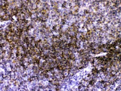 2 - Anti-CD40/TNFRSF5 Picoband Antibody ABO11670