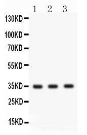 1 - Anti-Cathepsin G Picoband Antibody ABO11671