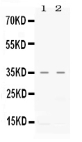1 - Anti-CXCL16 Picoband Antibody ABO11672