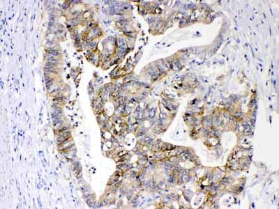 2 - Anti-EPCAM Picoband Antibody ABO11677
