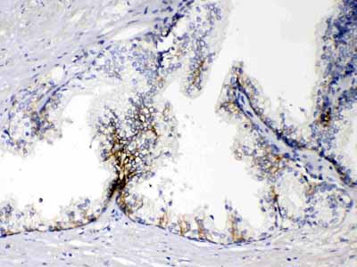 2 - Anti-EPCAM Picoband Antibody ABO11677