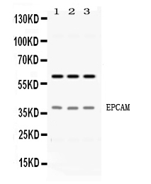 1 - Anti-EPCAM Picoband Antibody ABO11677
