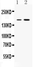 1 - Anti-CSB Picoband Antibody ABO11678