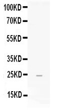 1 - Anti-FGF19 Picoband Antibody ABO11679