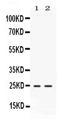 1 - Anti-FGF19 Picoband Antibody ABO11680