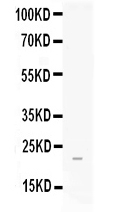 1 - Anti-FGF21 Picoband Antibody ABO11681