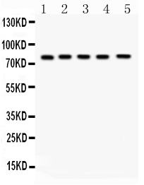1 - Anti-FSH Receptor Picoband Antibody ABO11683