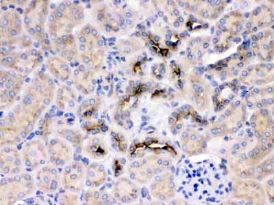 2 - Anti-GNB1 Picoband Antibody ABO11685