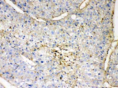 2 - Anti-GNB1 Picoband Antibody ABO11685