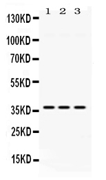 1 - Anti-GNB1 Picoband Antibody ABO11685