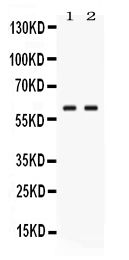 1 - Anti-GPI Picoband Antibody ABO11686