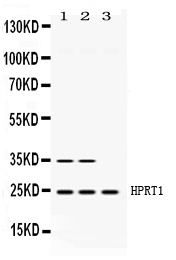1 - Anti-HPRT Picoband Antibody ABO11689