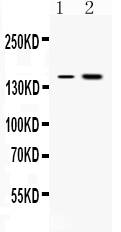 1 - Anti-Insulin Receptor Picoband Antibody ABO11690